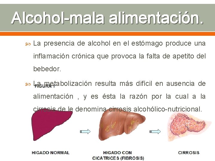 Alcohol-mala alimentación. La presencia de alcohol en el estómago produce una inflamación crónica que