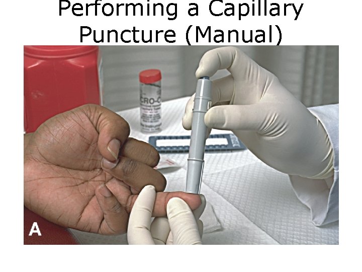 Performing a Capillary Puncture (Manual) Figure A Capillary puncture procedure. 