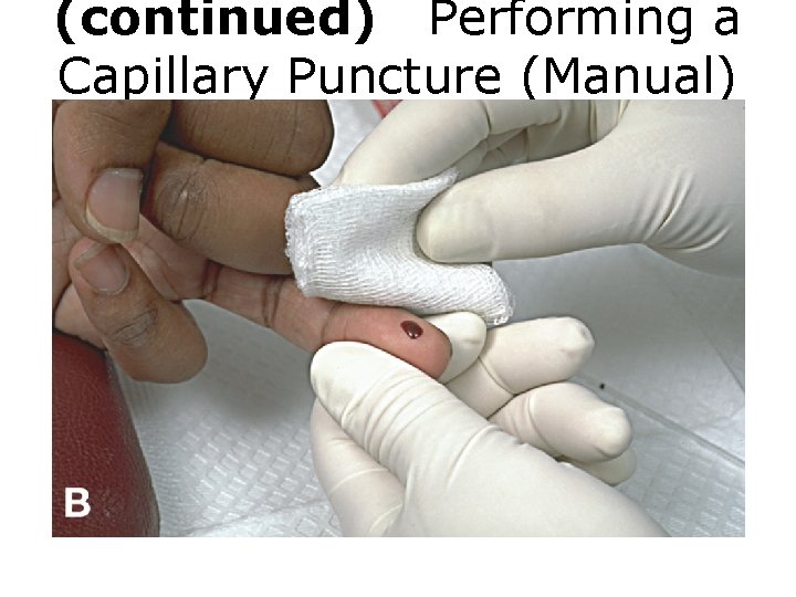 (continued) Performing a Capillary Puncture (Manual) Figure B Capillary puncture procedure. 