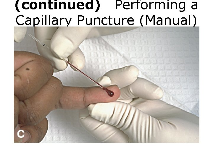 (continued) Performing a Capillary Puncture (Manual) Figure C Capillary puncture procedure. 