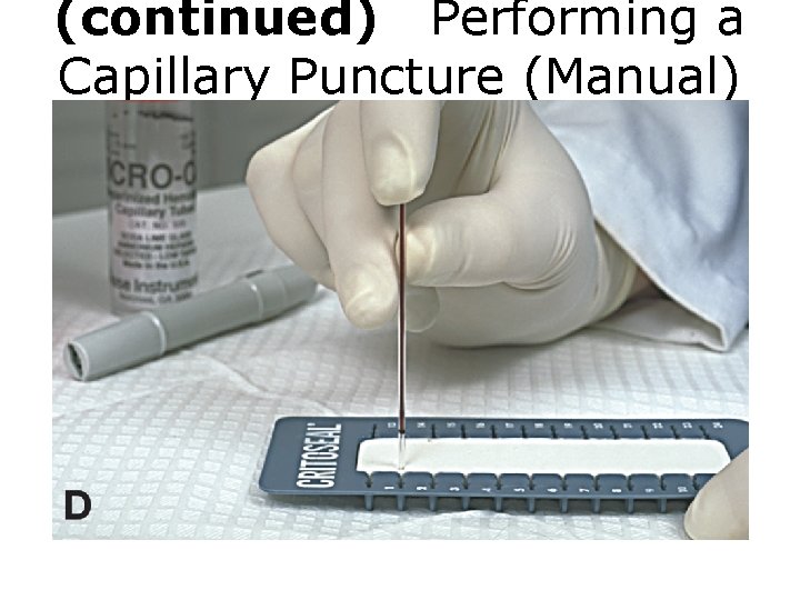 (continued) Performing a Capillary Puncture (Manual) Figure D Capillary puncture procedure. 