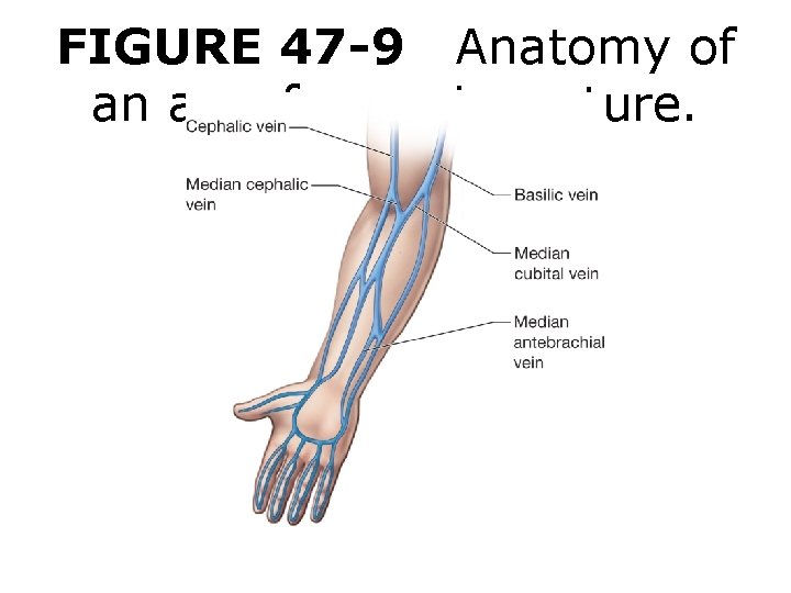 FIGURE 47 -9 Anatomy of an arm for venipuncture. 