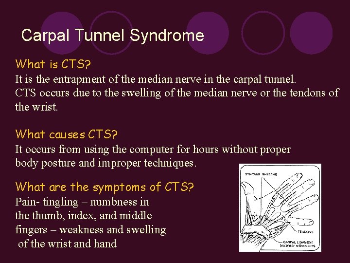 Carpal Tunnel Syndrome What is CTS? It is the entrapment of the median nerve