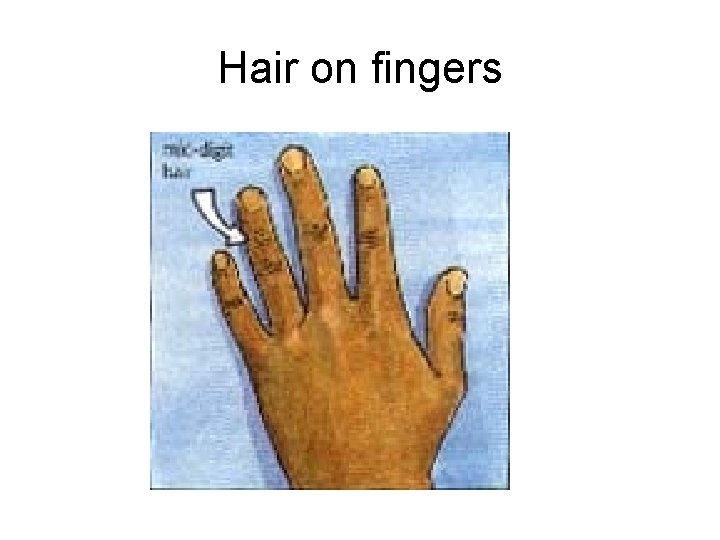 Hair on fingers 