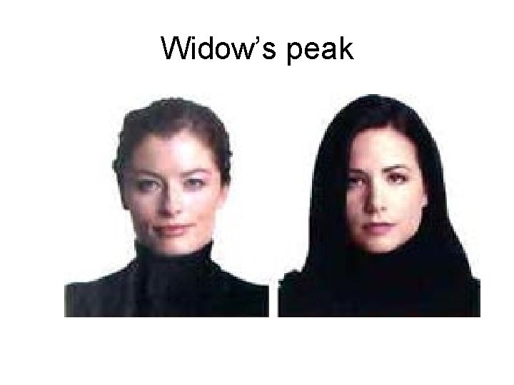 Widow’s peak 