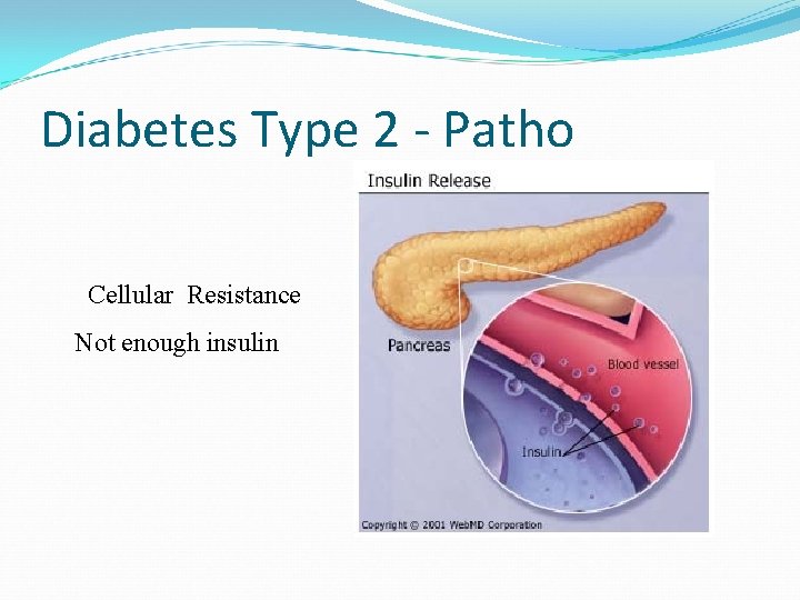 Diabetes Type 2 - Patho Cellular Resistance Not enough insulin 