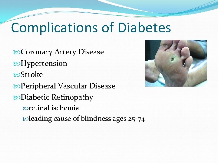 Complications of Diabetes Coronary Artery Disease Hypertension Stroke Peripheral Vascular Disease Diabetic Retinopathy retinal