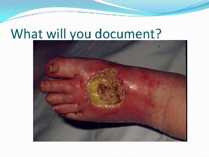 What will you document? 