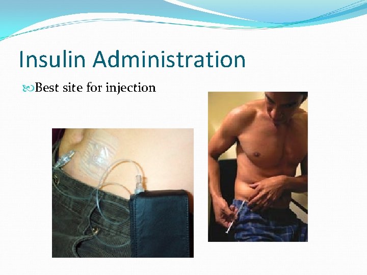 Insulin Administration Best site for injection 