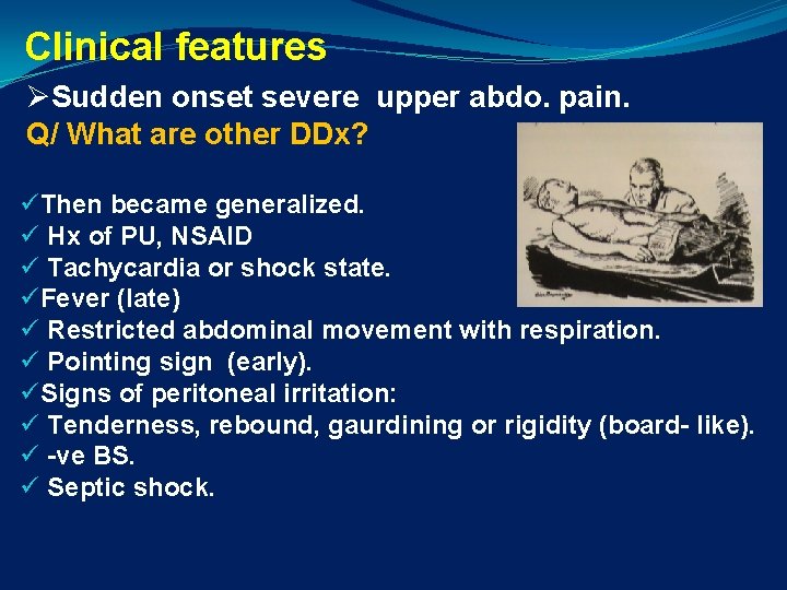 Clinical features ØSudden onset severe upper abdo. pain. Q/ What are other DDx? üThen