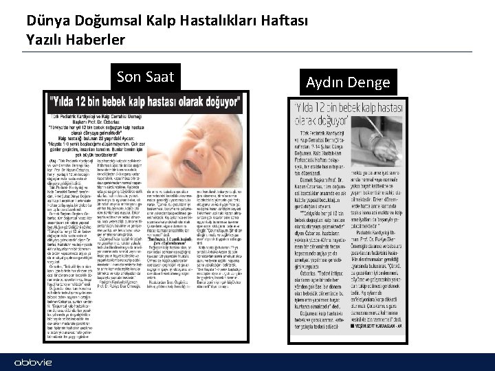 Dünya Doğumsal Kalp Hastalıkları Haftası Yazılı Haberler Son Saat Aydın Denge 