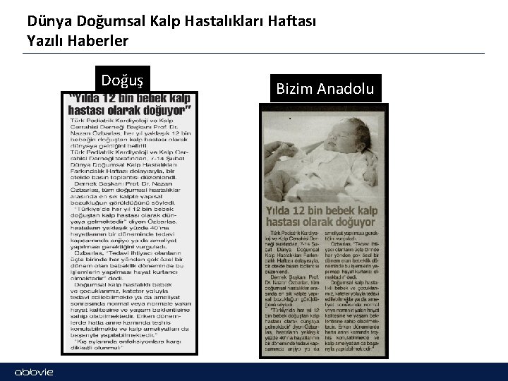 Dünya Doğumsal Kalp Hastalıkları Haftası Yazılı Haberler Doğuş Bizim Anadolu 