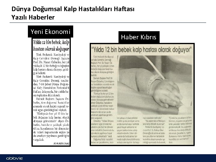 Dünya Doğumsal Kalp Hastalıkları Haftası Yazılı Haberler Yeni Ekonomi Haber Kıbrıs 