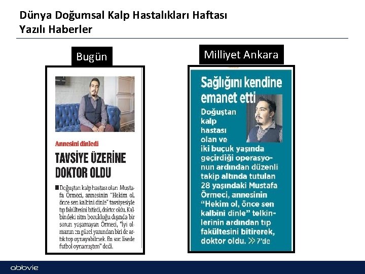 Dünya Doğumsal Kalp Hastalıkları Haftası Yazılı Haberler Bugün Milliyet Ankara 