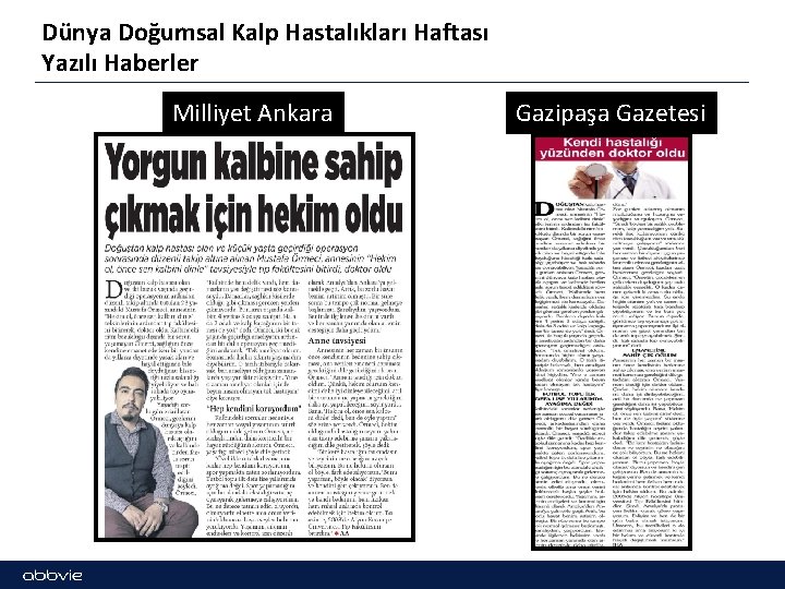 Dünya Doğumsal Kalp Hastalıkları Haftası Yazılı Haberler Milliyet Ankara Gazipaşa Gazetesi 