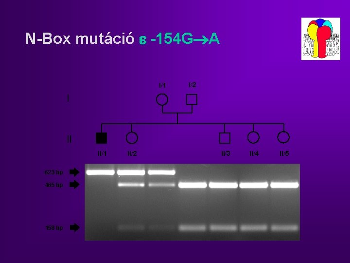 N-Box mutáció -154 G A I/1 I/2 I II II/1 623 bp 465 bp