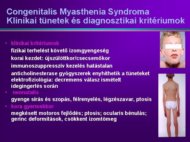 Congenitalis Myasthenia Syndroma Klinikai tünetek és diagnosztikai kritériumok • klinikai kritériumok fizikai terhelést követő