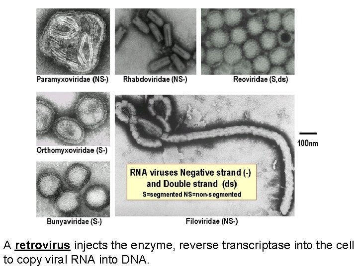 A retrovirus injects the enzyme, reverse transcriptase into the cell to copy viral RNA