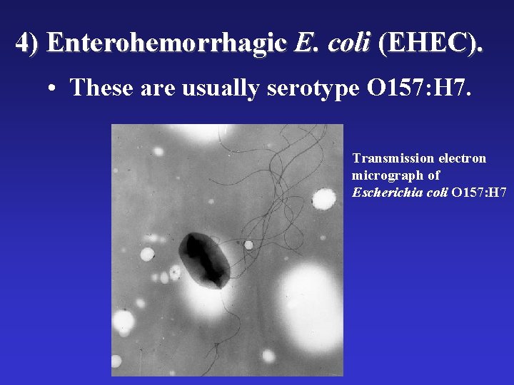 4) Enterohemorrhagic E. coli (EHEC). • These are usually serotype O 157: H 7. 4) Enterohemorrhagic E. coli (EHEC). • These are usually serotype O 157: H 7.