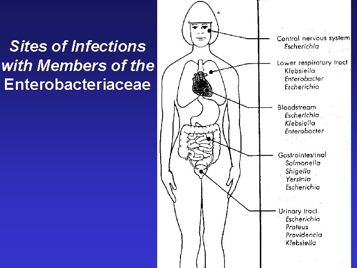 Sites of Infections with Members of the Enterobacteriaceae 
