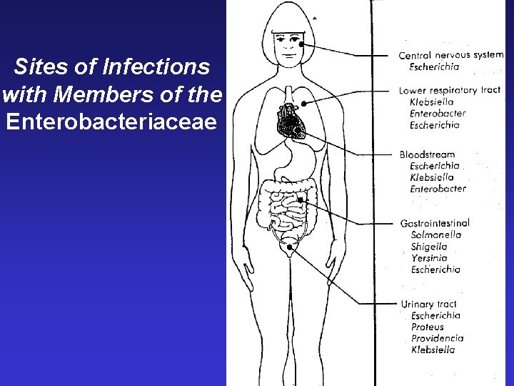 Sites of Infections with Members of the Enterobacteriaceae Sites of Infections with Members of the Enterobacteriaceae