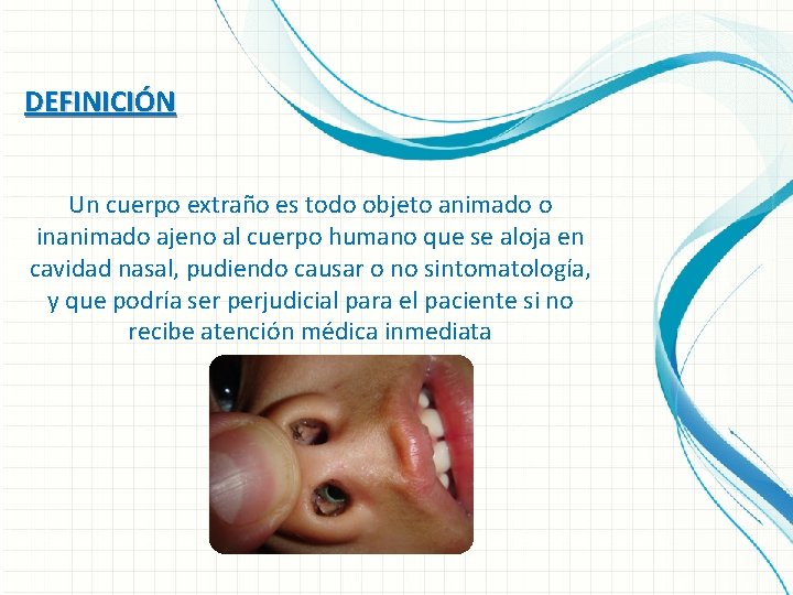 DEFINICIÓN Un cuerpo extraño es todo objeto animado o inanimado ajeno al cuerpo humano