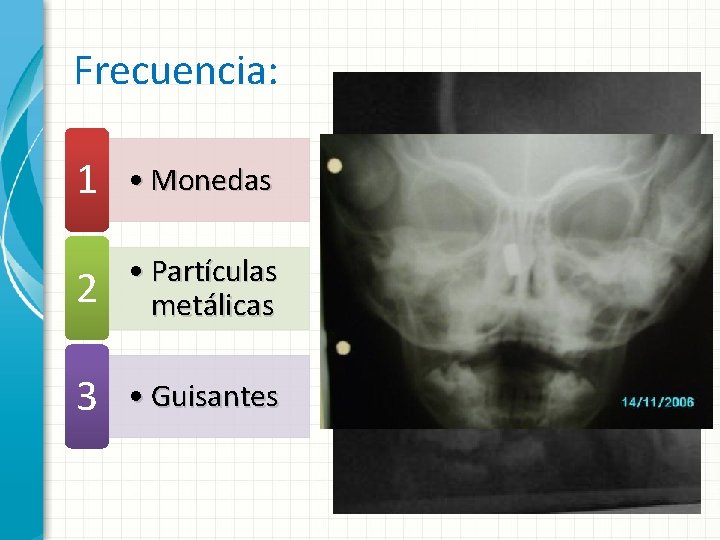 Frecuencia: 1 • Monedas 2 • Partículas metálicas 3 • Guisantes 