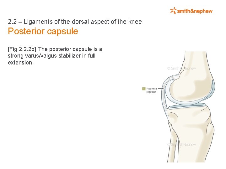2. 2 – Ligaments of the dorsal aspect of the knee Posterior capsule [Fig