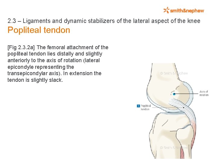 2. 3 – Ligaments and dynamic stabilizers of the lateral aspect of the knee