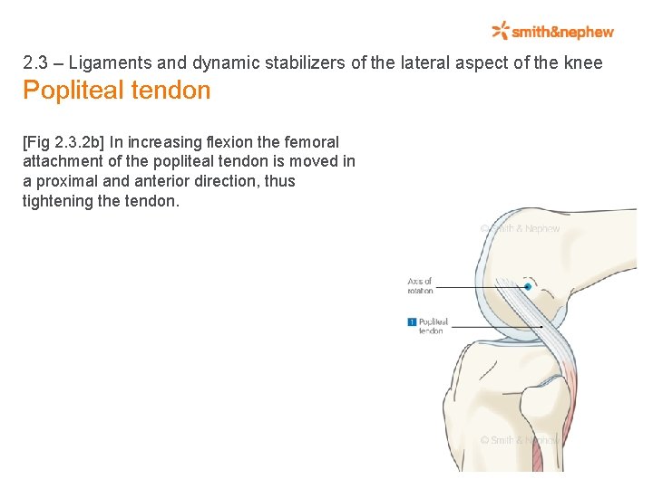 2. 3 – Ligaments and dynamic stabilizers of the lateral aspect of the knee