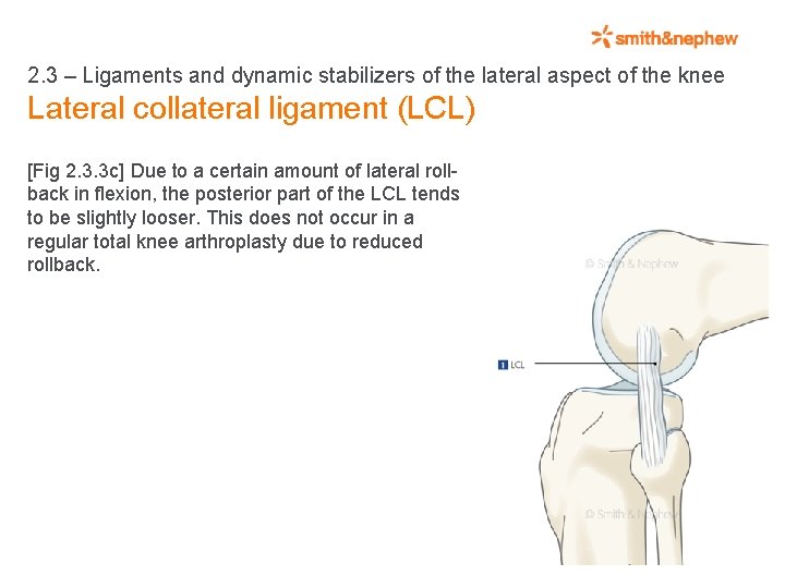 2. 3 – Ligaments and dynamic stabilizers of the lateral aspect of the knee
