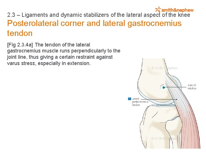 2. 3 – Ligaments and dynamic stabilizers of the lateral aspect of the knee