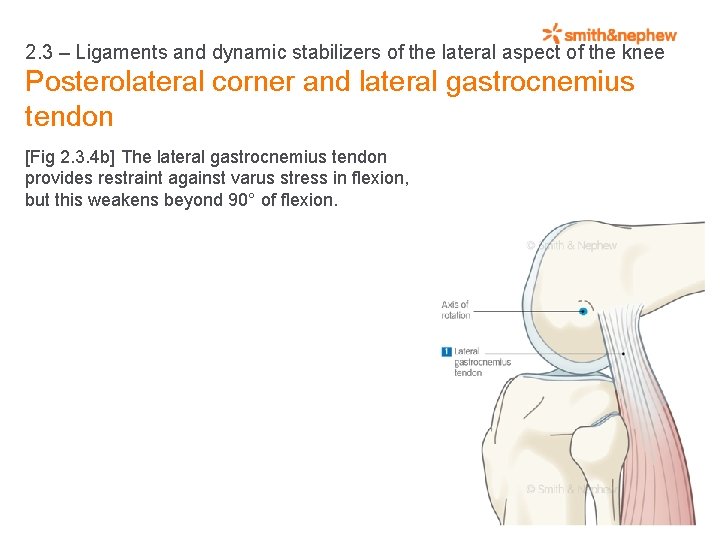 2. 3 – Ligaments and dynamic stabilizers of the lateral aspect of the knee