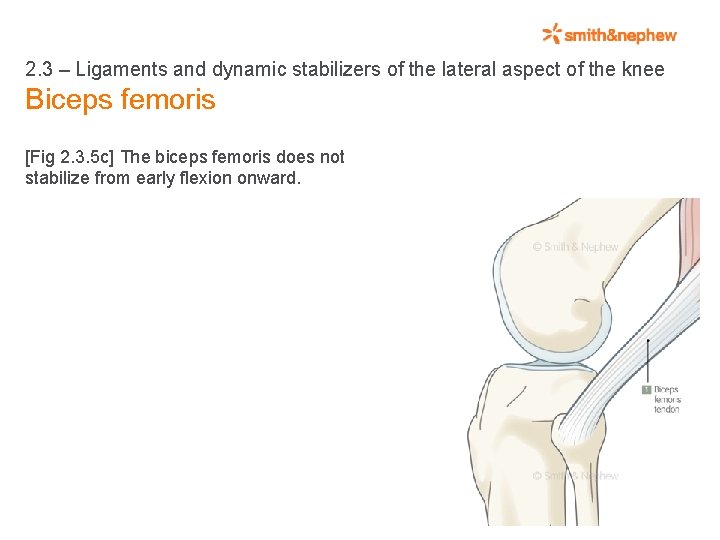 2. 3 – Ligaments and dynamic stabilizers of the lateral aspect of the knee