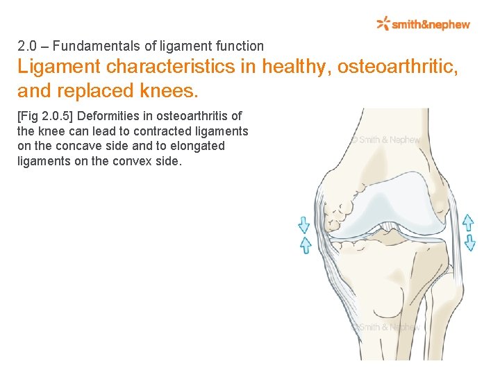 2. 0 – Fundamentals of ligament function Ligament characteristics in healthy, osteoarthritic, and replaced