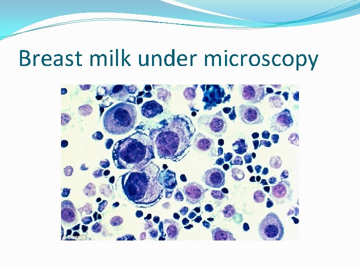 Breast milk under microscopy 