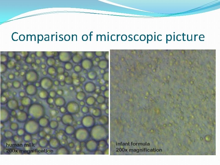 Comparison of microscopic picture 