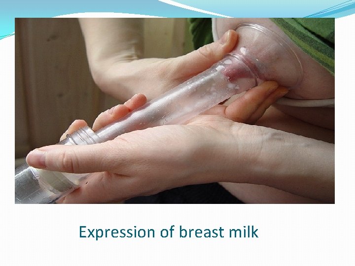 Expression of breast milk 