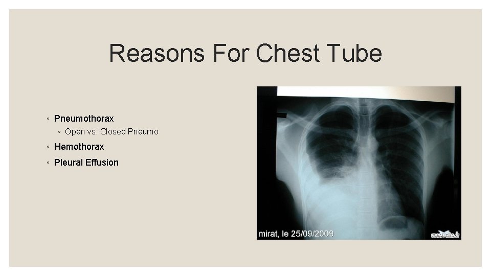 Reasons For Chest Tube ◦ Pneumothorax ◦ Open vs. Closed Pneumo ◦ Hemothorax ◦