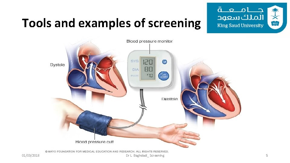 Tools and examples of screening 01/03/2018 Dr L. Baghdadi_ Screening 5 