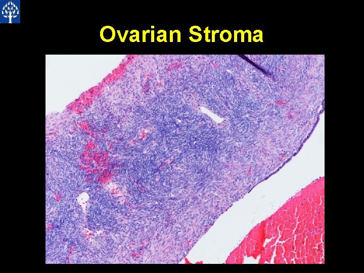 Ovarian Stroma 