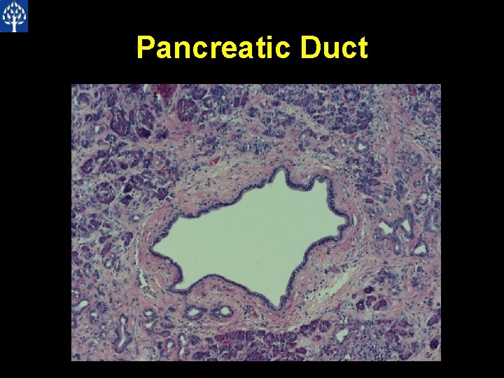 Pancreatic Duct 