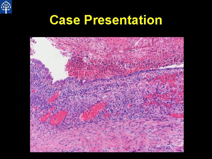 Case Presentation 