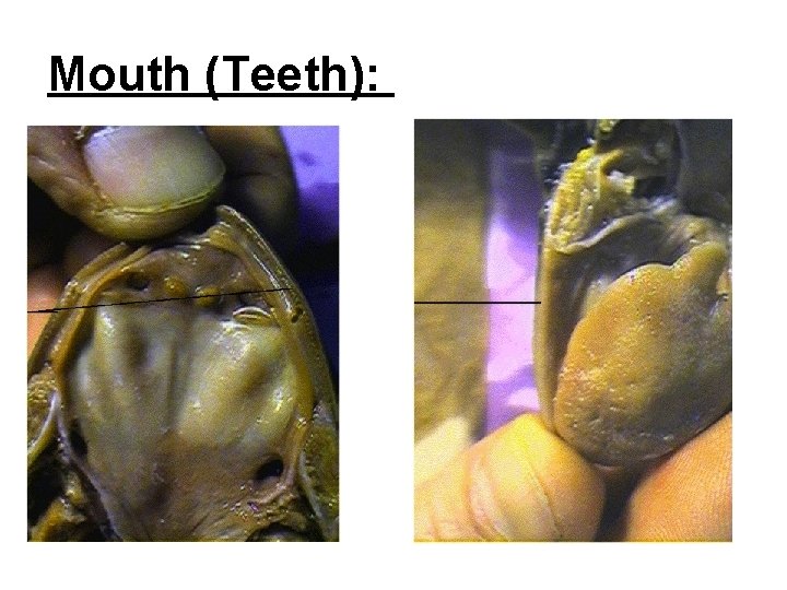 Mouth (Teeth): 
