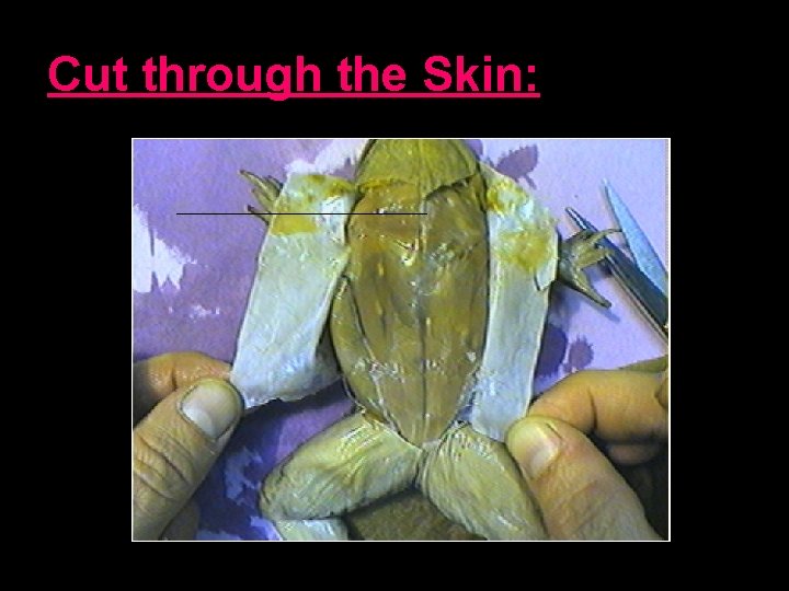 Cut through the Skin: 