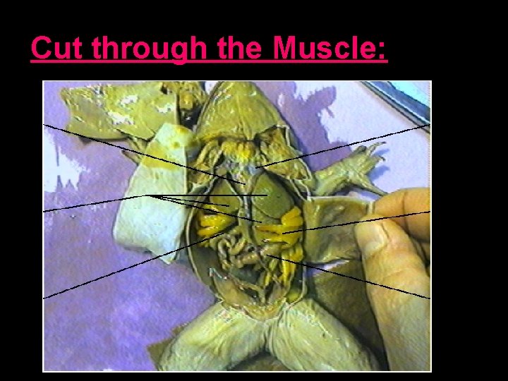 Cut through the Muscle: 