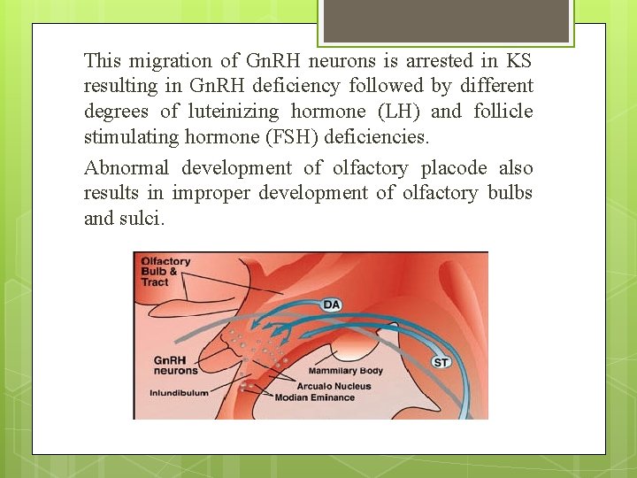 This migration of Gn. RH neurons is arrested in KS resulting in Gn. RH