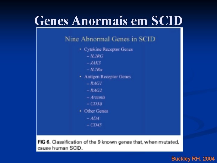 Genes Anormais em SCID Buckley RH, 2004 