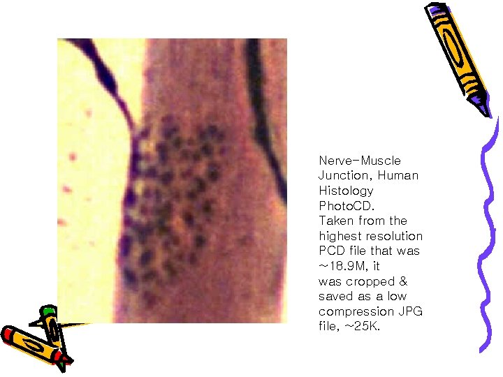 Nerve-Muscle Junction, Human Histology Photo. CD. Taken from the highest resolution PCD file that