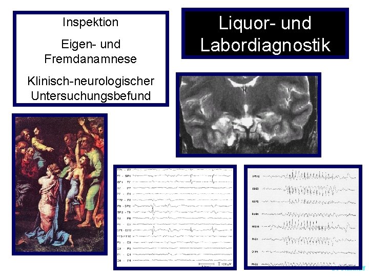 Inspektion Eigen- und Fremdanamnese Liquor- und Labordiagnostik Klinisch-neurologischer Untersuchungsbefund BJ Steinhoff 